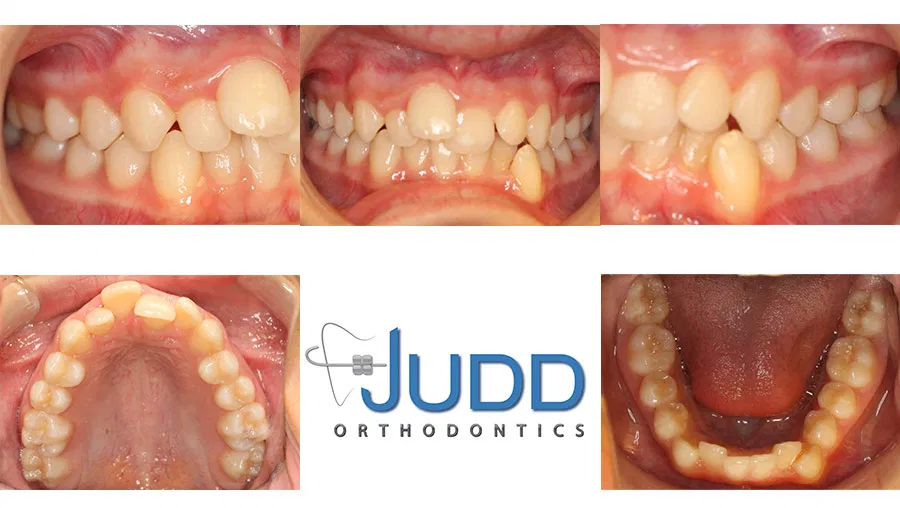 Judd Orthodontics