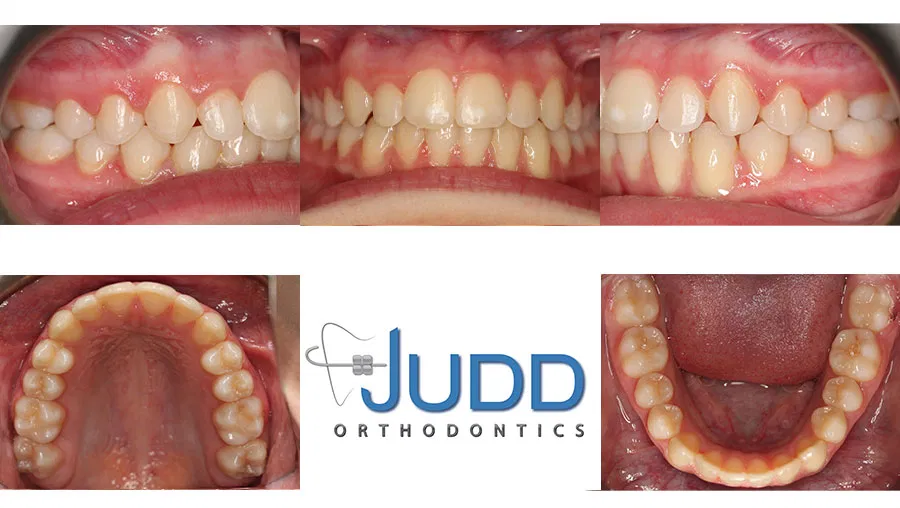 Judd Orthodontics