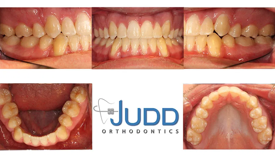 Judd Orthodontics