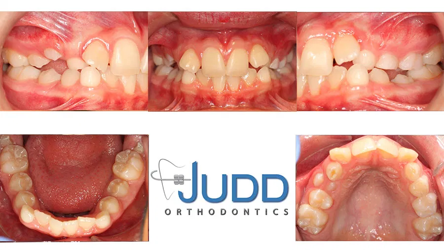 Judd Orthodontics