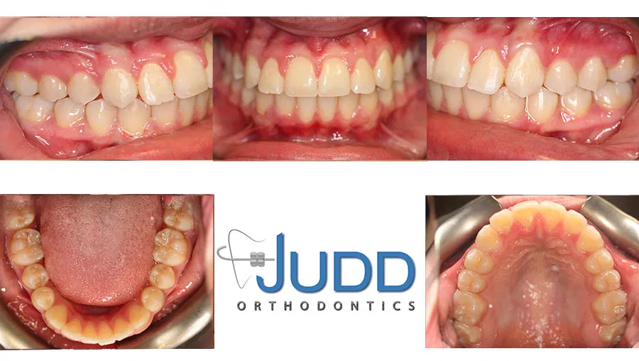 Judd Orthodontics