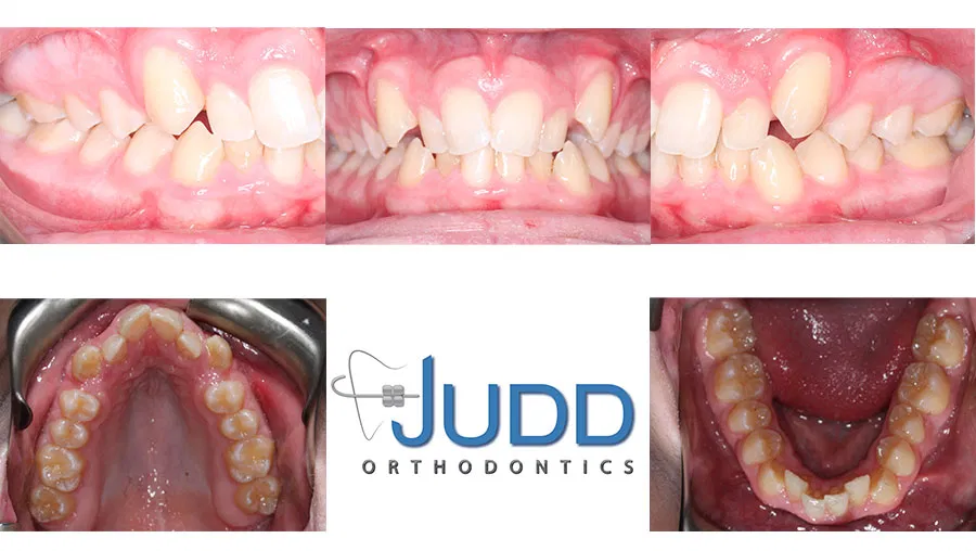 Judd Orthodontics