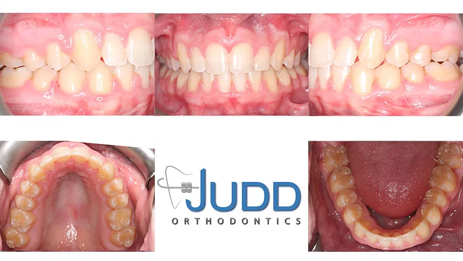 Judd Orthodontics
