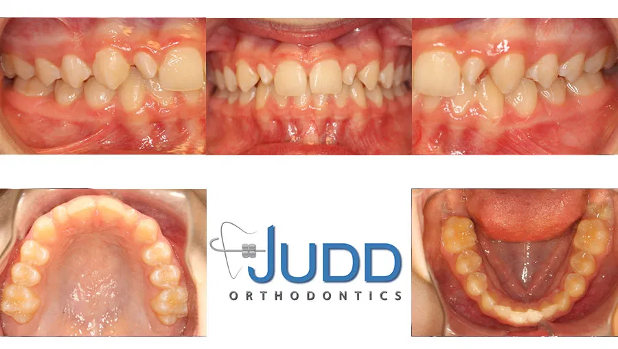 Judd Orthodontics