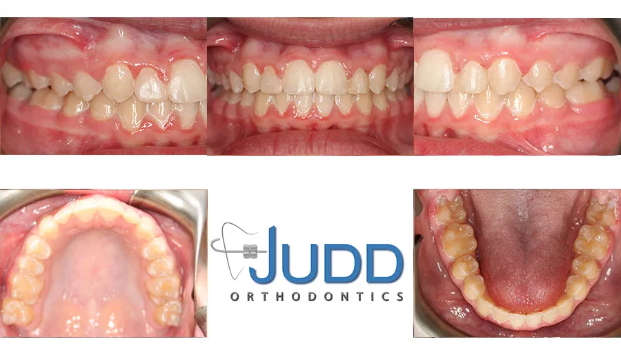 Judd Orthodontics