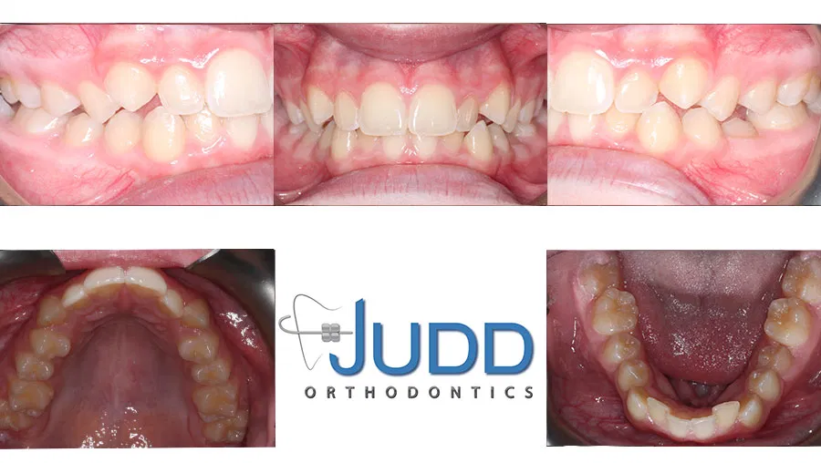 Judd Orthodontics