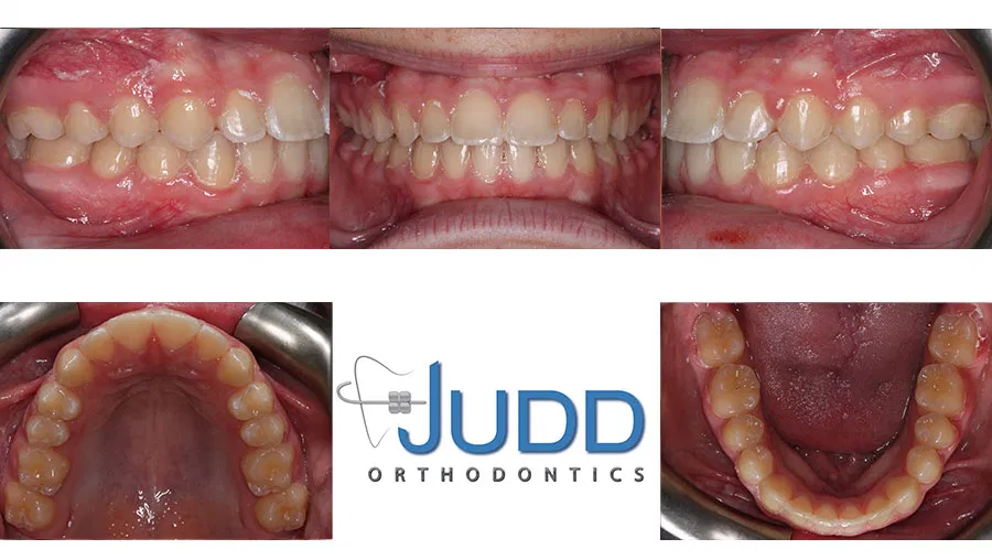 Judd Orthodontics