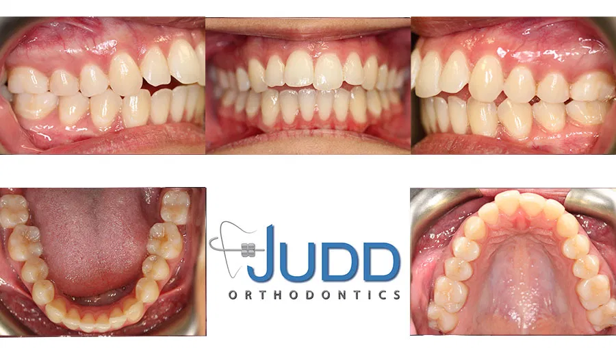 Judd Orthodontics