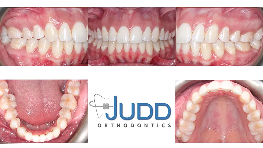 Judd Orthodontics